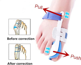 Foot Orthotic Bunion Splint Crooked  Thumb Corrector (1 Pair)